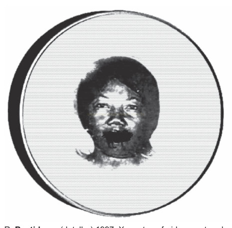 Retrato reticulado em preto e branco do rosto de uma criança dentro de um círculo.