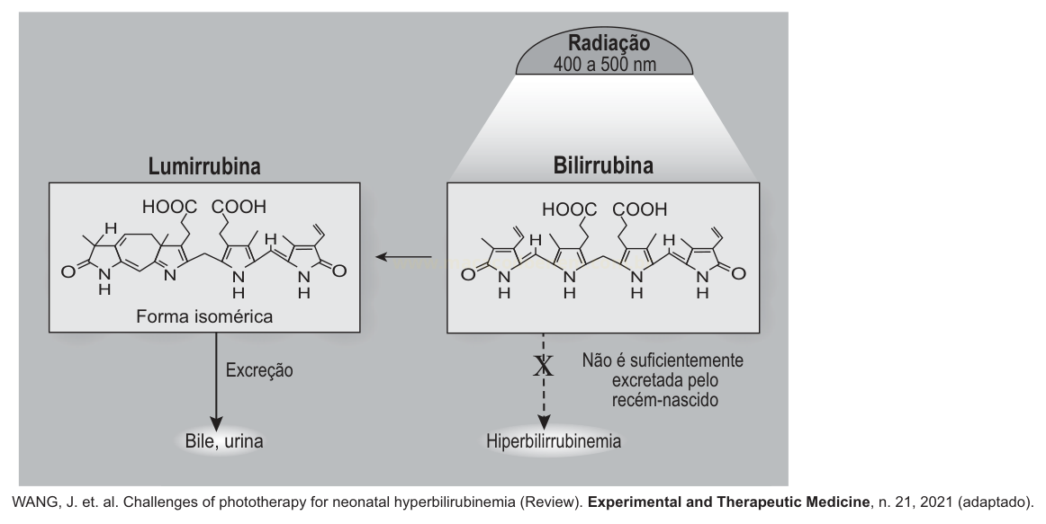 Infográfico mostrando a radiação convertendo bilirrubina em lumirrubina e as rotas de excreção e hiperbilirrubinemia.