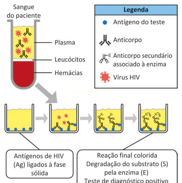 Esquema em etapas de um teste diagnóstico para HIV, do sangue do paciente à reação colorida positiva.