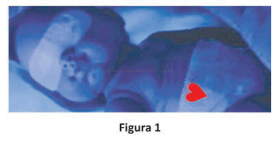 Imagem azulada de uma pessoa deitada, com um coração vermelho marcado sobre o tórax.