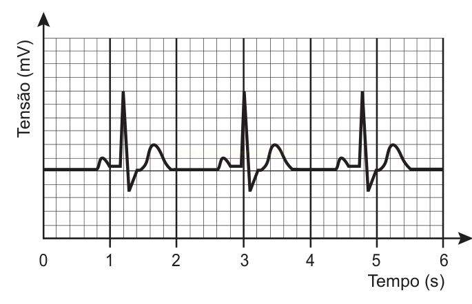 Gráfico de tensão em milivolts por tempo em segundos, com três ciclos repetidos de ondas e picos afiados.