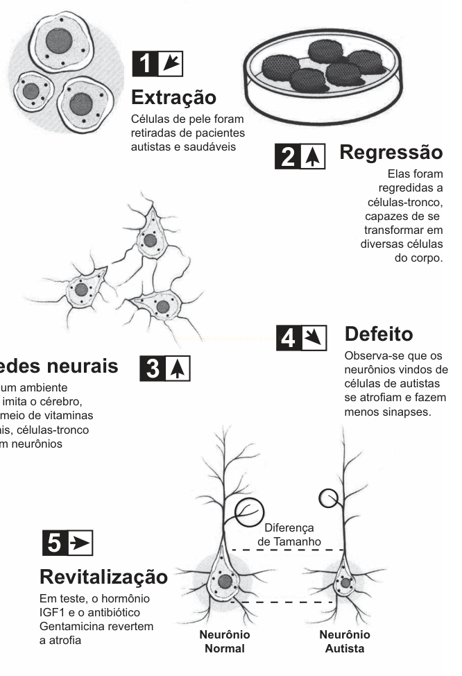 Infográfico de cinco etapas sobre células de pacientes autistas: extração, regressão, redes neurais, defeito e revitalização.