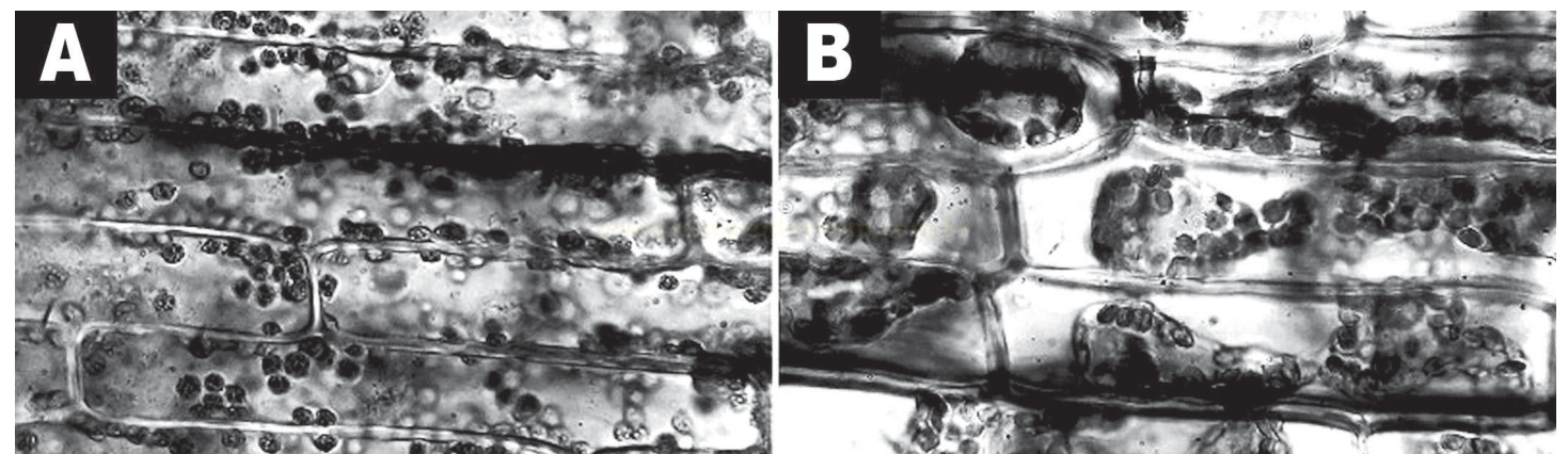 Duas micrografias em preto e branco de células alongadas contendo estruturas escuras arredondadas, com padrões diferentes em A e B.