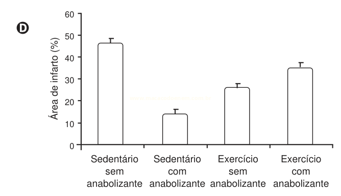 Gráfico de barras da área de infarto (%) em quatro grupos, com o menor valor no grupo sedentário com anabolizante.
