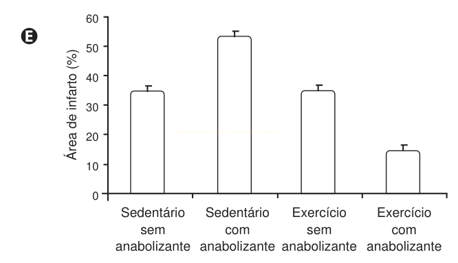 Gráfico de barras da área de infarto (%) em quatro grupos, com destaque para o sedentário com anabolizante.